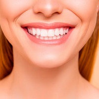 Как долго держится реставрация зубов?